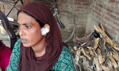 नकाबपोश बदमाशों ने महिला के कान से सोने के कुंडल नोचे