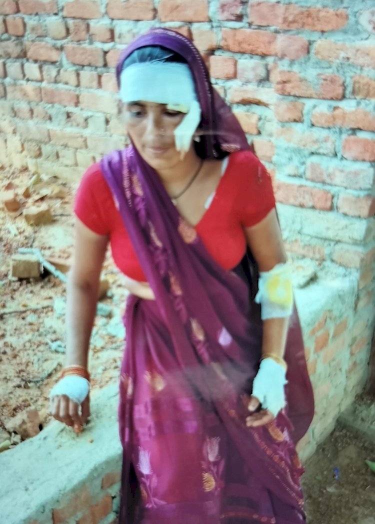 बाइक सवार लुटेरों ने महिला के कुंडल लूटे, चलती बाइक से गिरकर गंभीर रूप से घायल हुई महिला