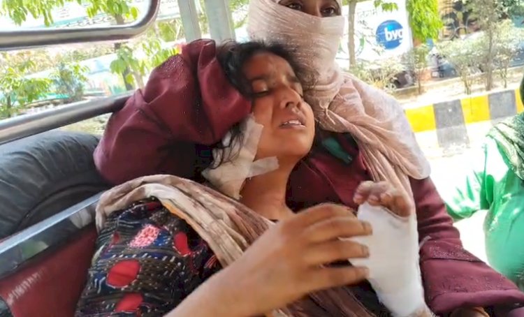 बहू पर जानलेवा हमला, इंसाफ की दरकार