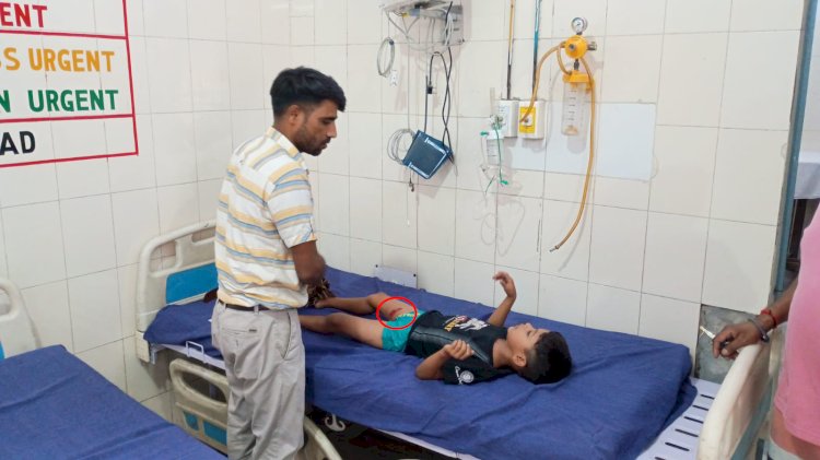 बरेली: हजियापुर में पड़ोस के पालतू कुत्ते ने घर में घुसकर मासूम पर किया हमला, पैर चबाया, जिला अस्पताल में भर्ती