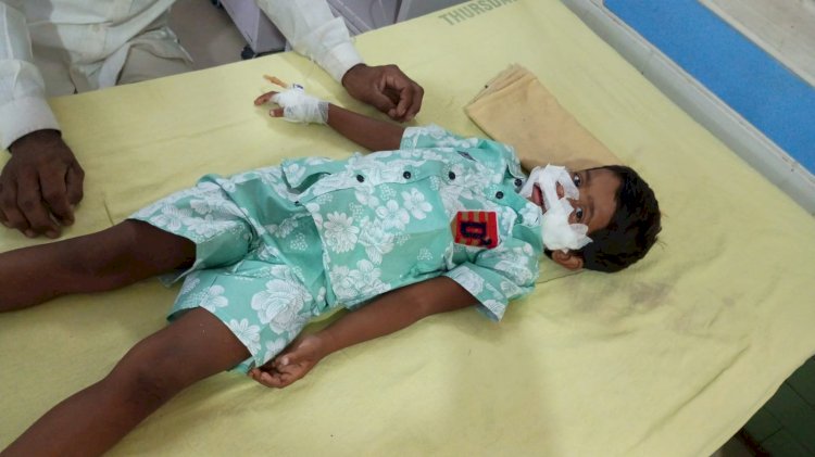 आवारा कुत्ते के हमले में डेढ़ वर्षीय मासूम गंभीर घायल