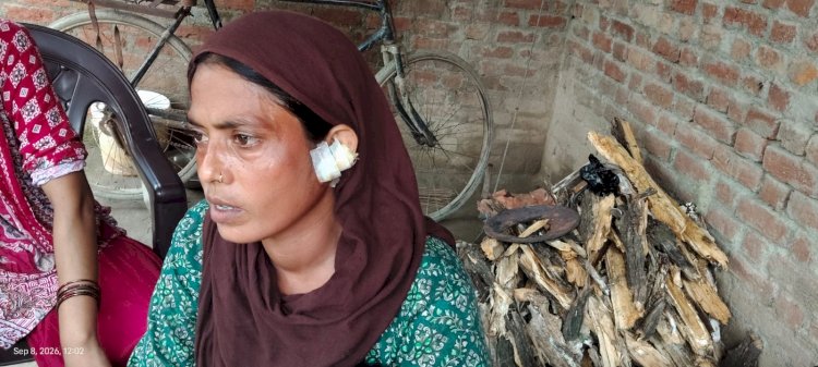 नकाबपोश बदमाशों ने महिला के कान से सोने के कुंडल नोचे