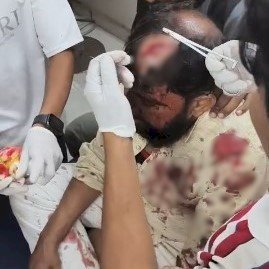 पुलिया के पास बाइक सवार युवक पर डंडे से हमला
